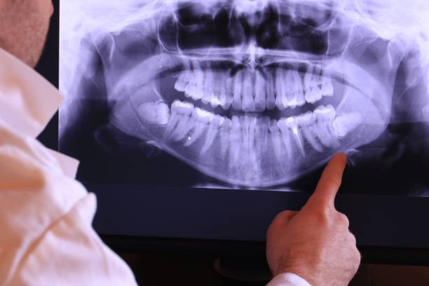 Tooth Infection Emergency Dentist in IA